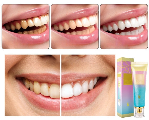 Triple Whitening Niacinamide Whitening Toothpaste – Advanced Whitening for a Brighter Smile2