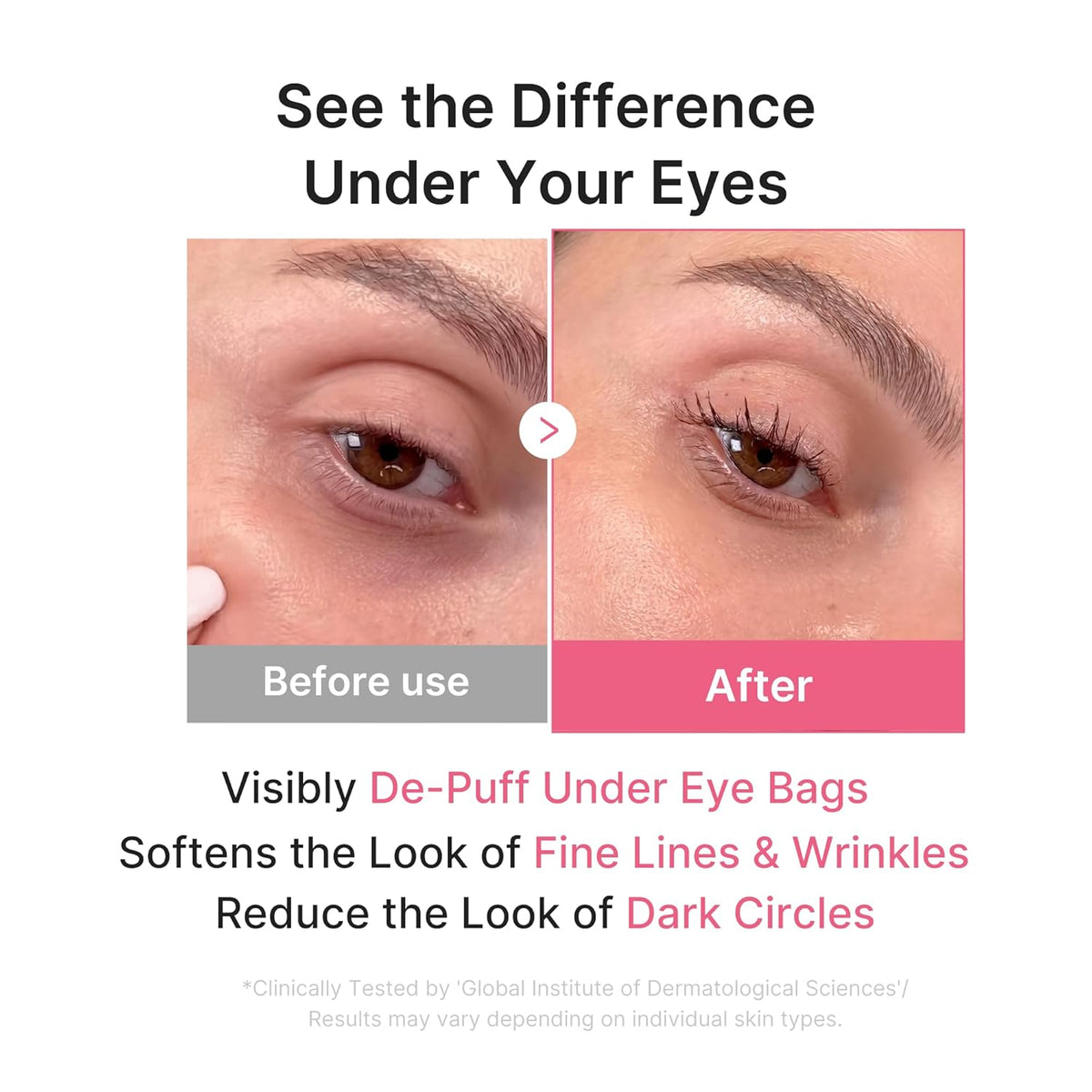 medicube Jelly Eye Mask PDRN Pink Collagen | Hydrogel Eye Patches