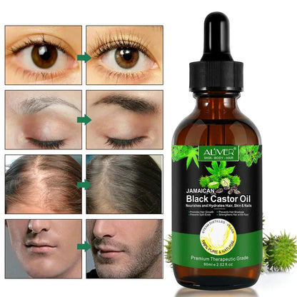 Aliver 100% Pure & Natural Jamaican Black Castor Oil