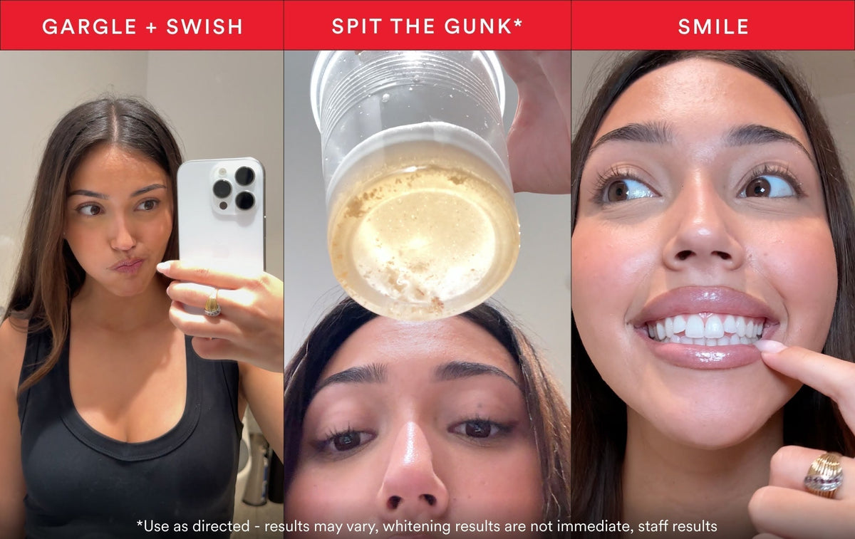 iD Stain Whitening Mouthwash