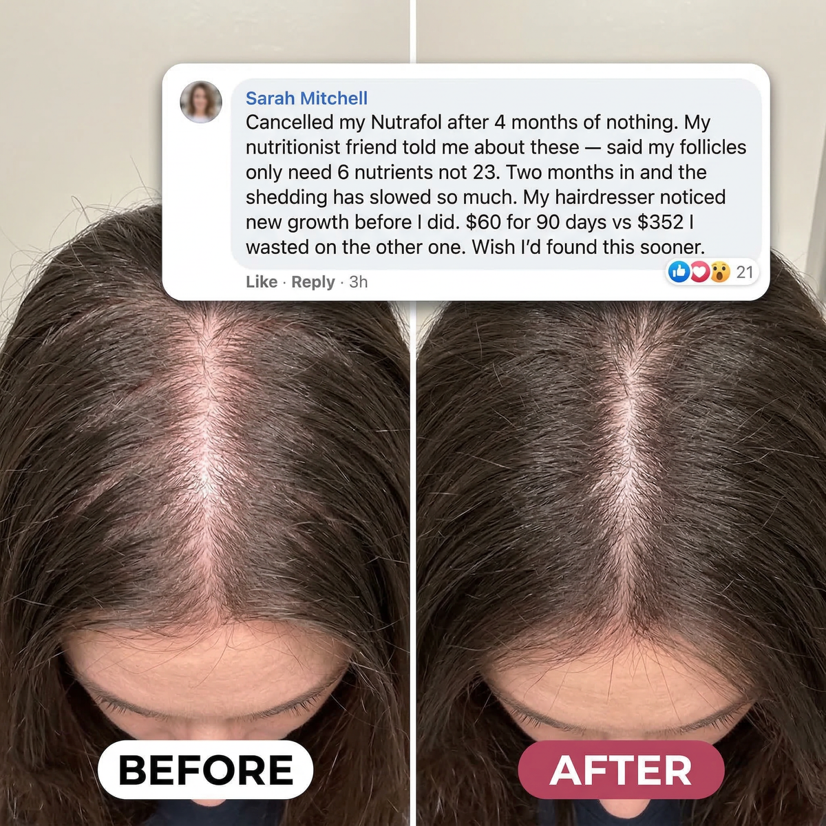Ah-Mazing Hair
Vitamin Gummies