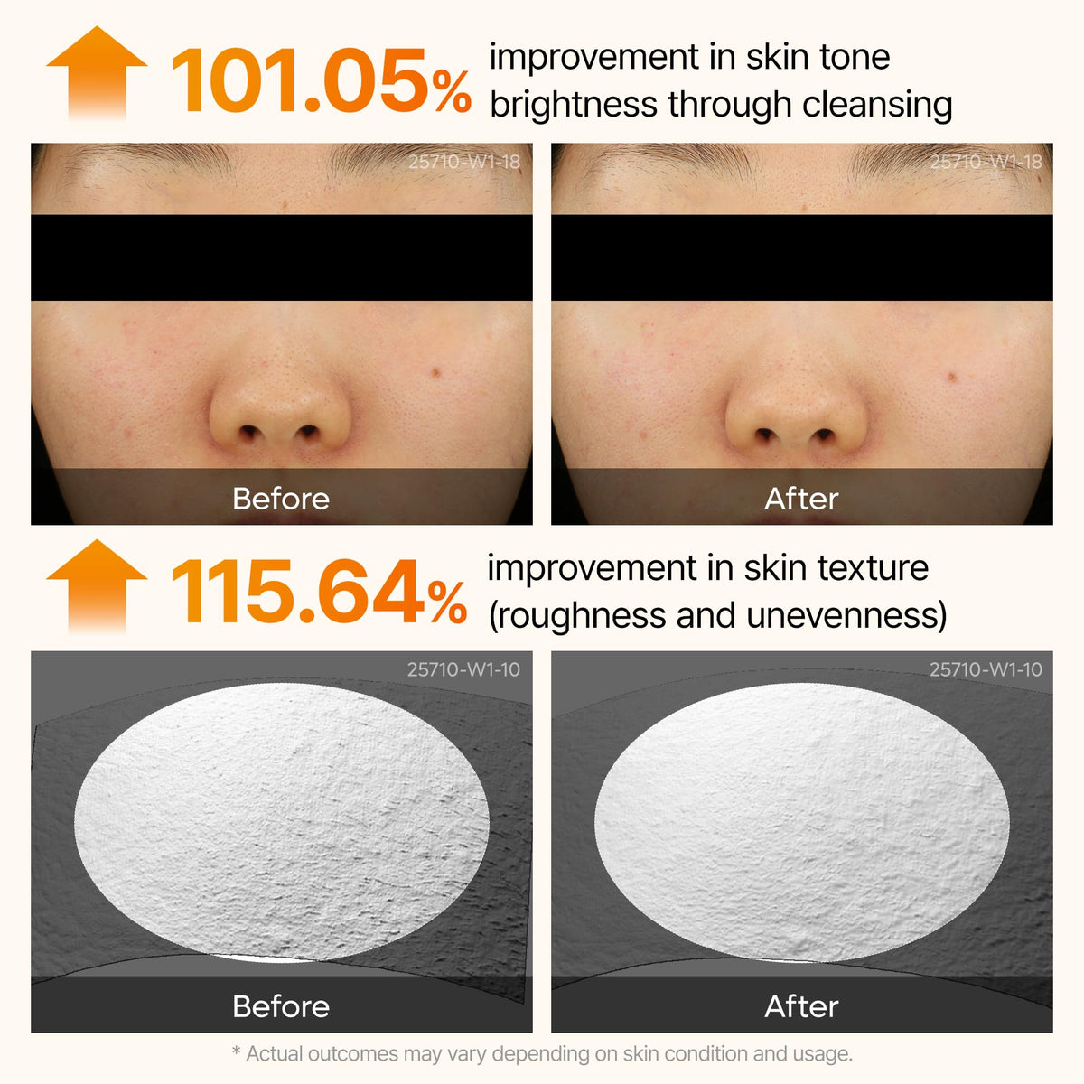 Dr.Melaxin Peel Shot Kojic Acid Turmeric Serum — 80ml exfoliating AHA/BHA pore-refining brightening ampoule