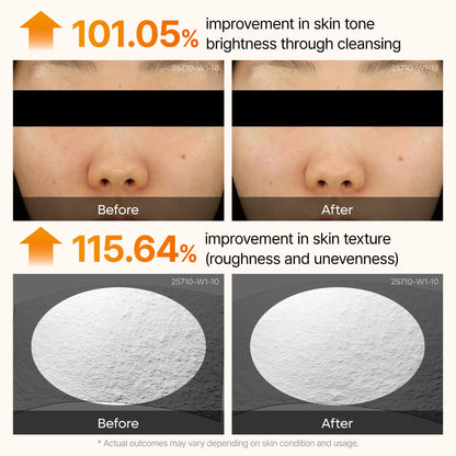 Dr.Melaxin Peel Shot Kojic Acid Turmeric Serum — 80ml exfoliating AHA/BHA pore-refining brightening ampoule